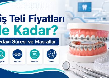 Diş Teli Fiyatları Ne Kadar? Tedavi Süresi ve Masraflar